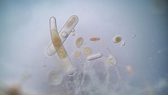 260217_CERTANIA_Biotec_AI_microscopic_microorganisms 260217_CERTANIA_Biotec_AI_microscopic_microorganisms
