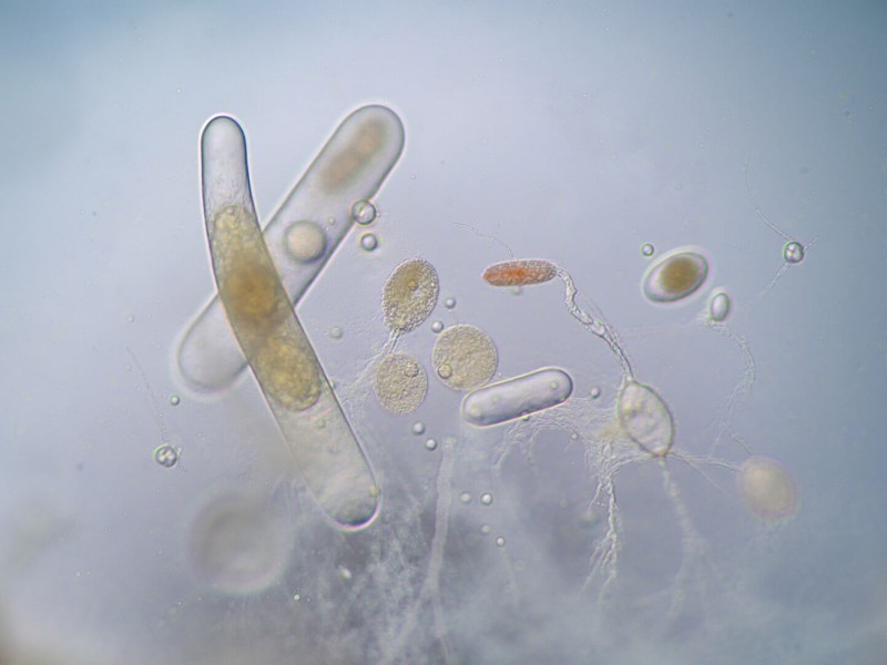 260217_CERTANIA_Biotec_AI_microscopic_microorganisms